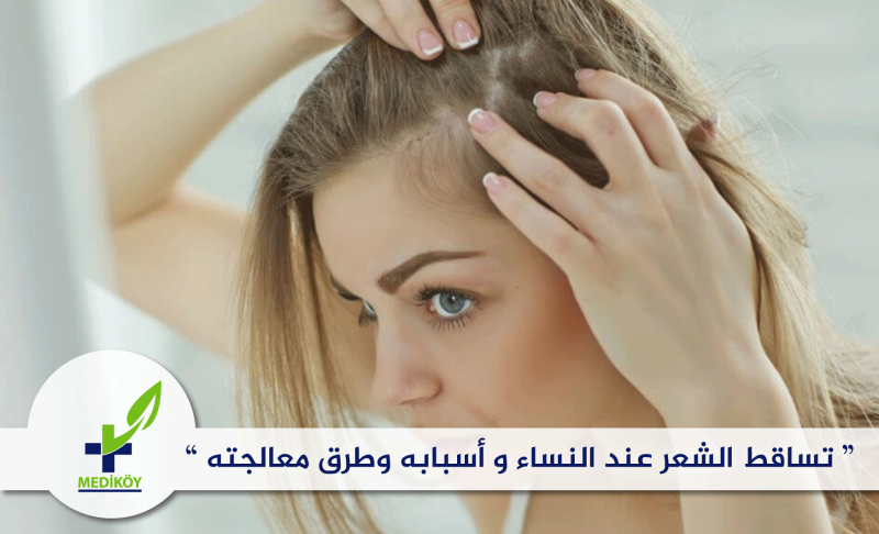 زراعة الشعر للنساء