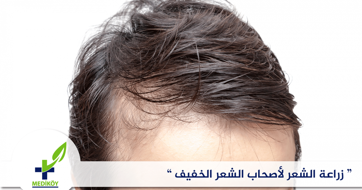 زراعة الشعر لاصحاب الشعر الخفيف