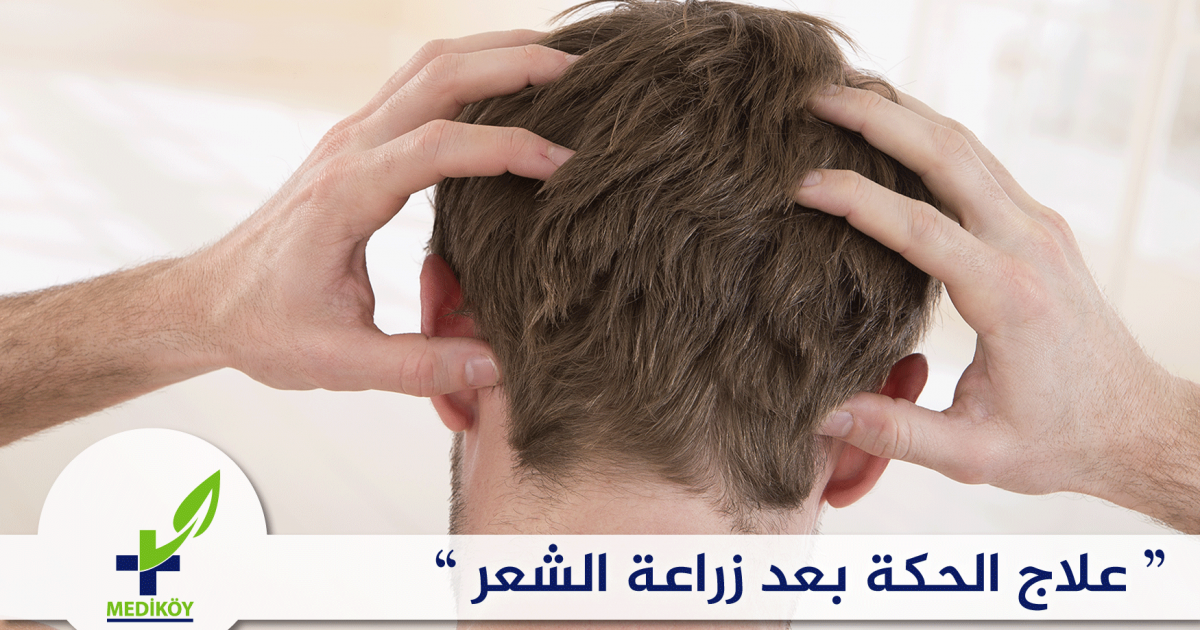 علاج الحكة بعد زراعة الشعر