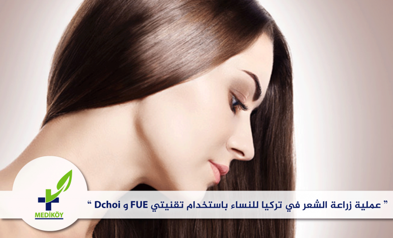 زراعة الشعر للنساء أفضل مشفى لزراعة الشعر في تركيا مشفى ميديكوي