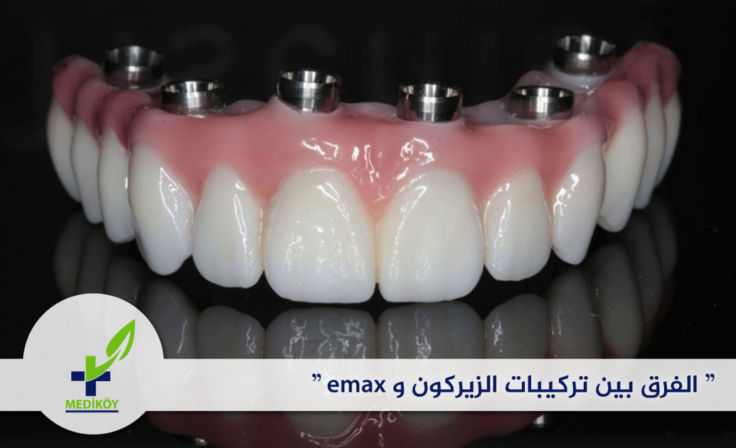 الفرق بين تركيبات الزيركون و Emax